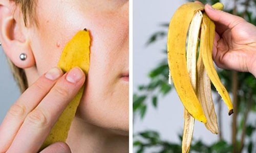 رفع نیش حشرات از فواید موز برای بیماری ها