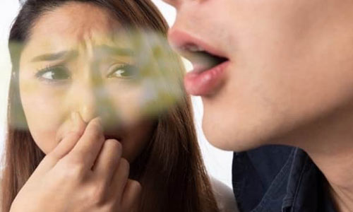 بوی بد دهان