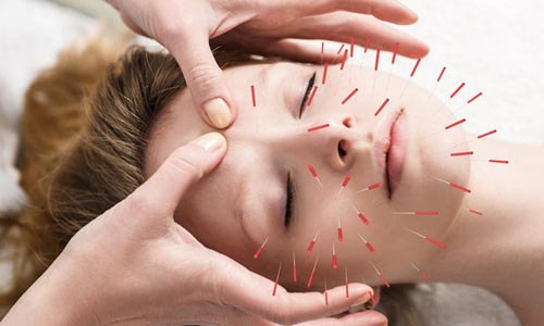 برای دیابت باید از طب سوزنی و حجامت استفاده کنند