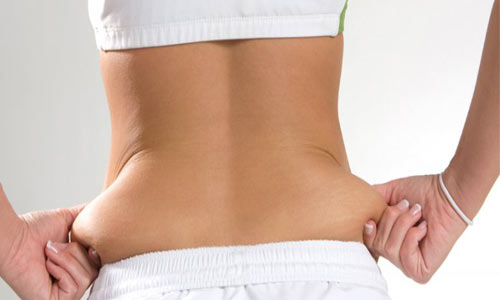 پیشگیری از چاقی