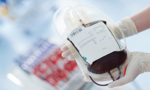 مراحل انجام اهدای خون